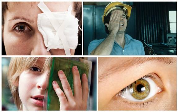 Ушиб глаза: симптомы и лечение в домашних условиях